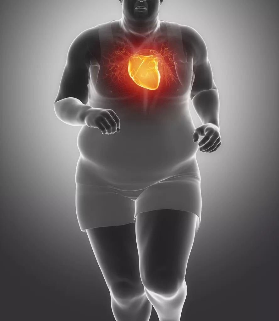 肥胖有心血管疾病风险微胖要不要减肥