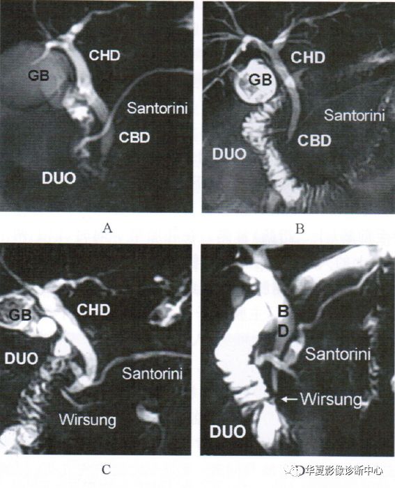 a,b:胰腺的santorini管开口于十二指肠副乳头,胆总管下端指向位置较低