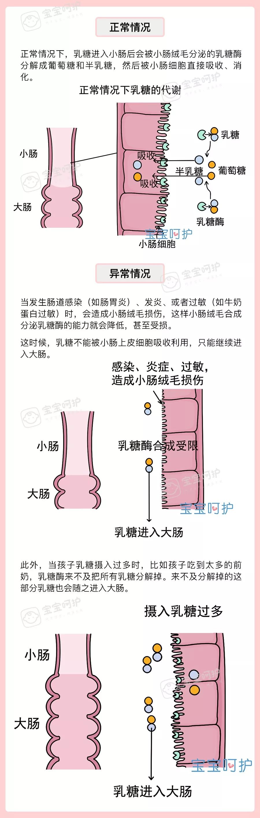 乳糖不耐受主要分为两种类型,原发性和继发性.