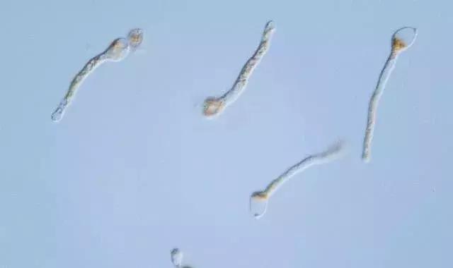 梨锈病的病原菌是由担子菌亚门冬孢菌纲锈菌目胶锈菌属的梨胶锈菌(g.