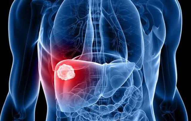 医生建议肝脏受损伤人吃一种主食一种蔬菜一种肉能养肝