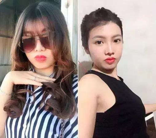 女子太丑没人娶,怒花十万整容闪婚嫁富豪!你们这些男人啊.
