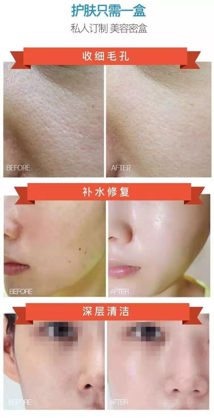 9元抢购小气泡脸部清洁!vip免费拔罐!贺州人美容护肤就来这!
