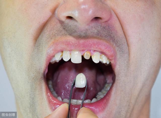 当心牙缝大真的会漏财
