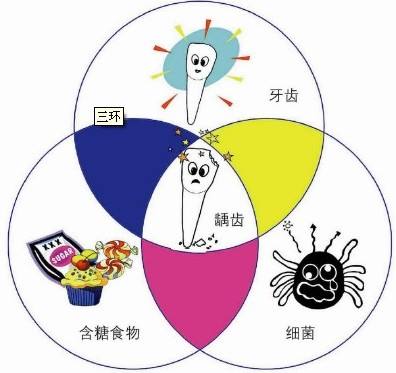 目前學者普遍認為,齲病的發生發展是多因素共同作用的結果,其中細菌