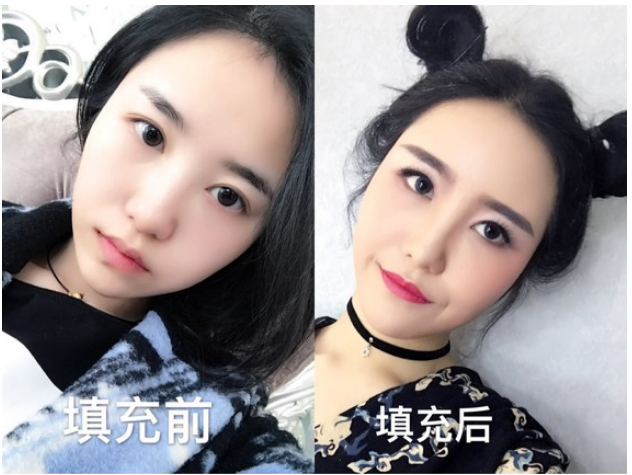 原创新氧app再爆丑闻整容图片疑似造假平台还能严谨一点吗