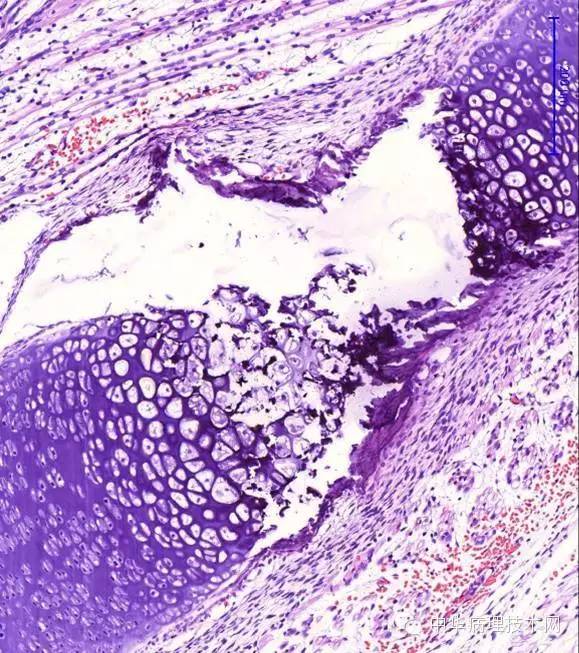 脱钙后的切片:用微波和超声波脱钙,是一个好办法,一般50℃温度,微波