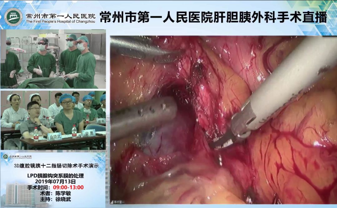 3个多小时18000多人观看这家医院高难度外科手术直播获点赞