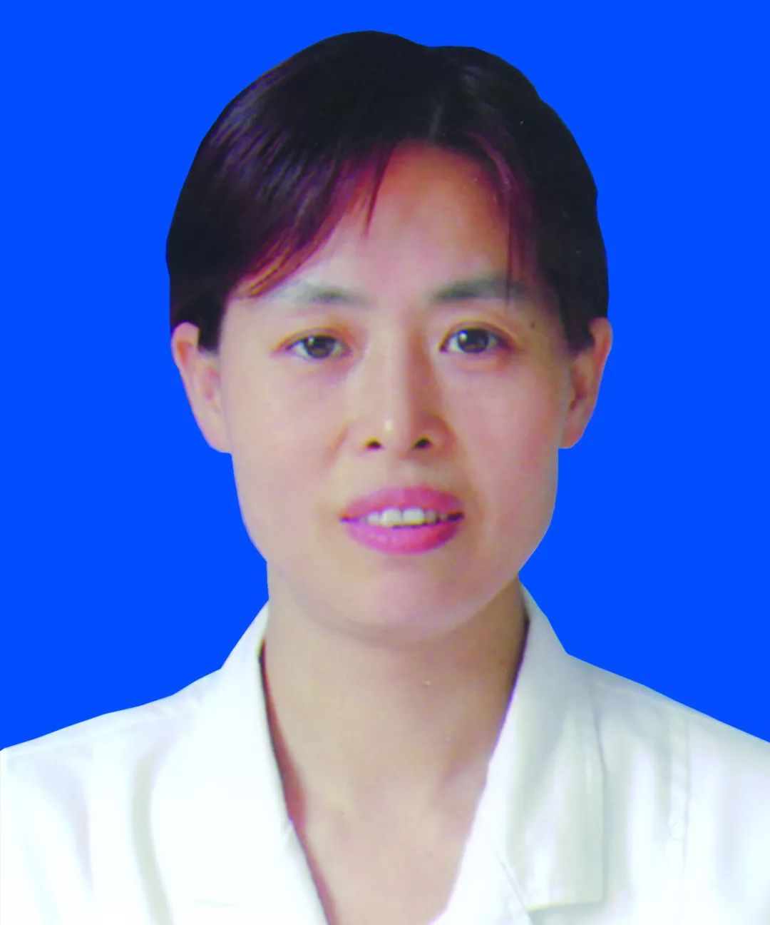 王秀兰诊疗特长:能熟练开展胸腔镜及腹腔镜等微创手术;食管癌,贲门癌