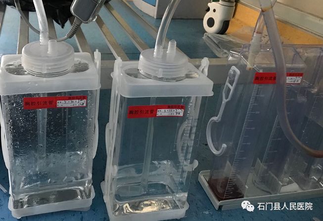 石门县人民医院呼吸介入诊疗技术再上新台阶!