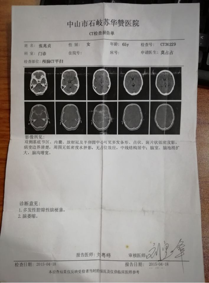 头部CT报告图片