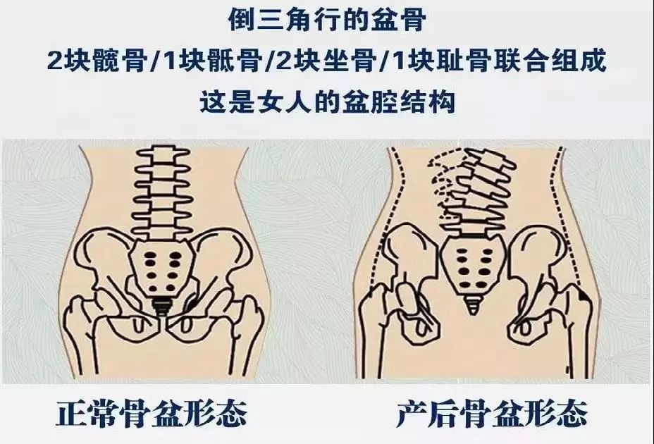 贵港宝妈们的福音骨科医院专业骨盆修复辣妈保持少女感的秘密都在这了