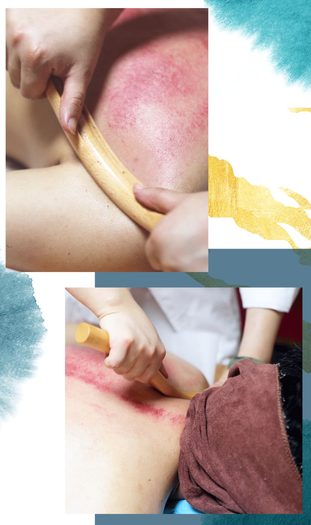 祛瘀生新"的效果还可以调节肌肉的的收缩和舒张而且大面积出痧,效果