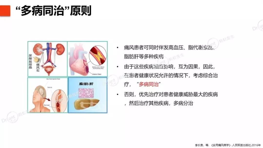 高尿酸血症与痛风的标准化治疗方案