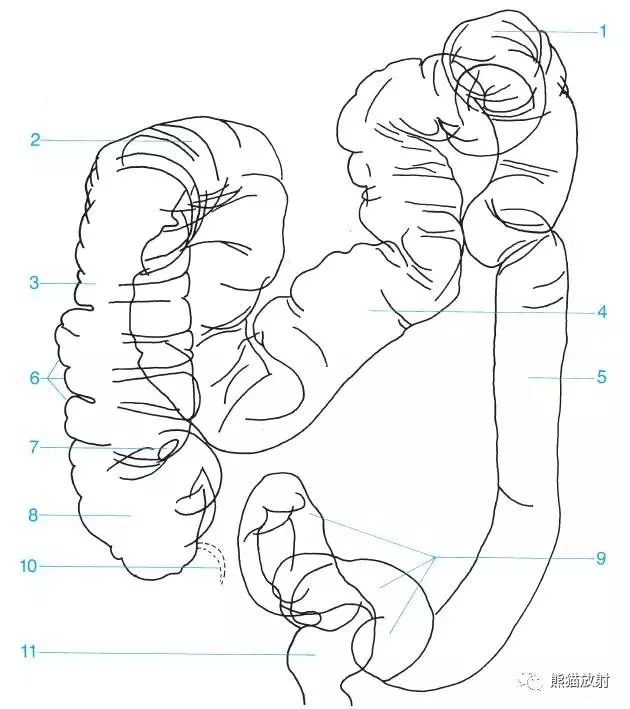 圖20 1 結腸脾曲,2 結腸肝曲,3 升結腸,4 橫結腸,5 降結腸,6 結腸袋,7
