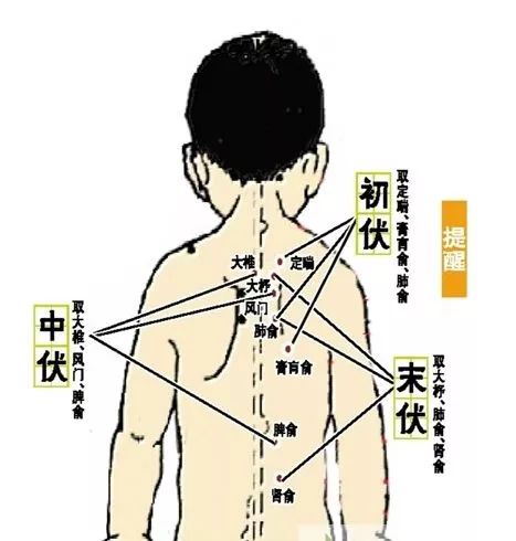 专家解答:三伏贴治疗过敏性鼻炎该贴哪儿?