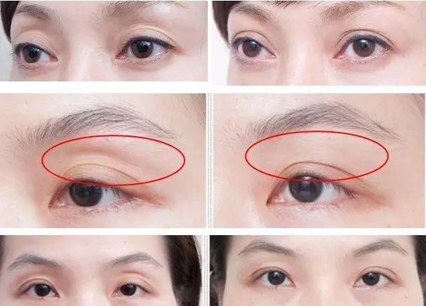 术后应如何保养?