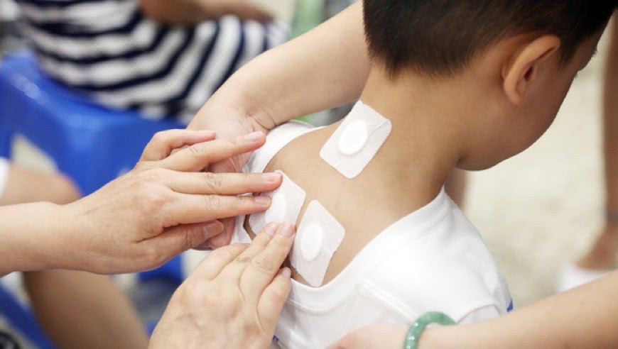 较真丨90多名儿童烫伤,请谨慎对待贴三伏贴