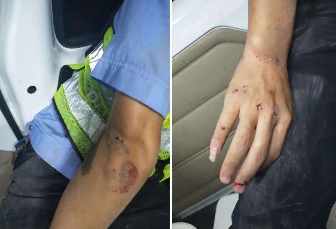 【微普法】宁乡男子玉煤大道拒检,撞伤交警,胆太大了