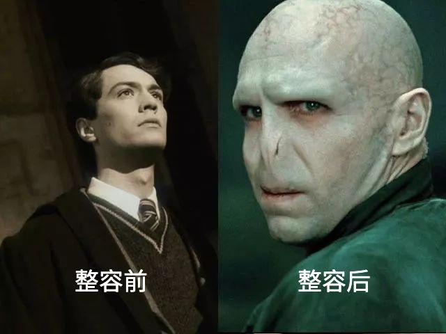"我变秃了,也变强了"——伏地魔年幼一点的,是接过邓布利多衣钵的中二
