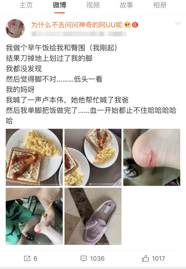 趙夢玥做飯不小心把腳割傷看到盧本偉的反應趙夢玥徹底寒心了