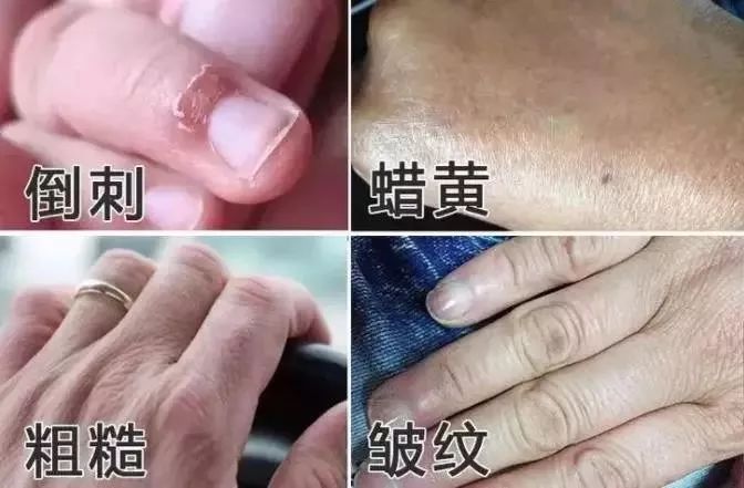 一涂一撕带走死皮抚平细纹让主妇手变少女白嫩手