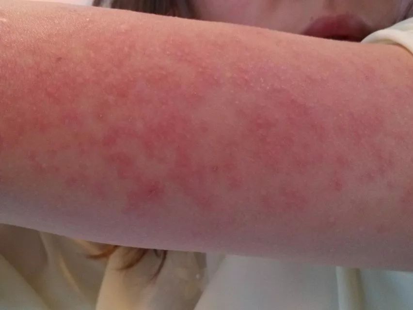 恶臭刺鼻,细菌含量居然是马桶的530倍!