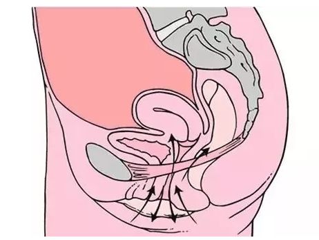 紧闭尿道,阴道及肛门(它们同时受到骨盆底肌肉撑),此感觉如尿急