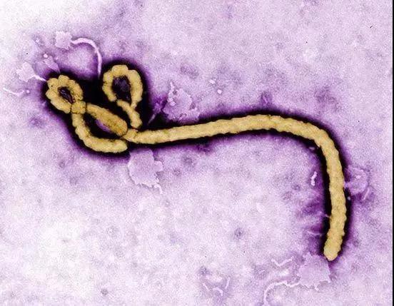 埃博拉这种出现了几十年的病毒,自从2014年在西非爆发并引起国际社会