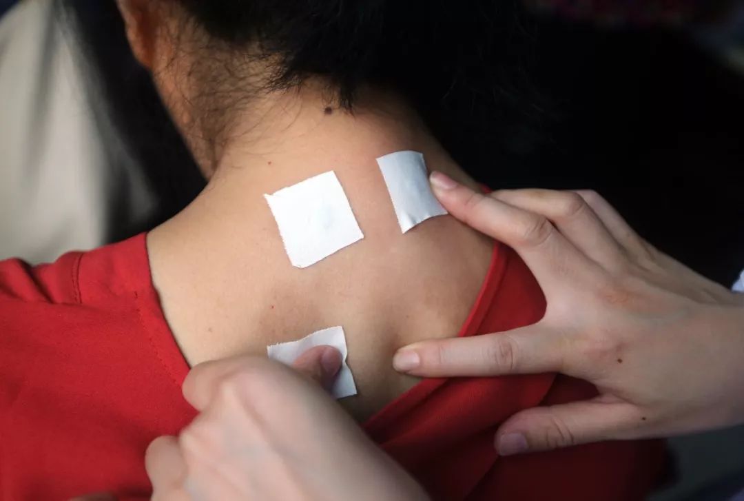 最佳!女人贴三伏贴有什么好处"笑逐颜开"-第1张图片-奶酪博客