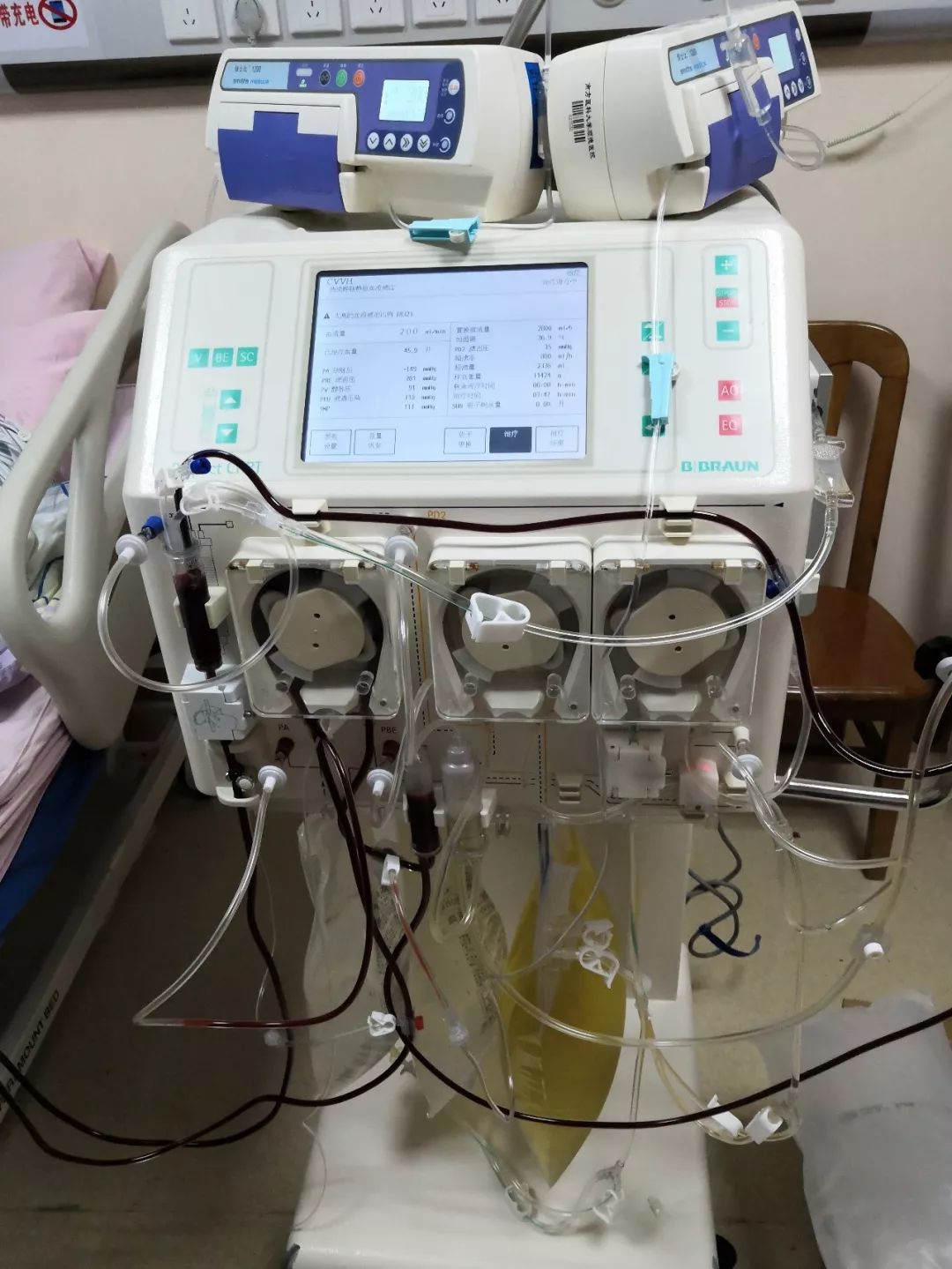 命悬一线,全身大换血!南医大顺德医院成功救治高危产妇!