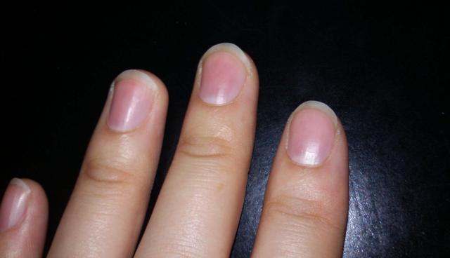 数数自己指甲月牙,如果低于8个,快艾灸这几个穴位_阳气