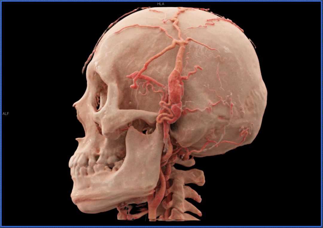 我所引进世界最先进ct应用新技术——国内首家应用 图像极度逼真_三维
