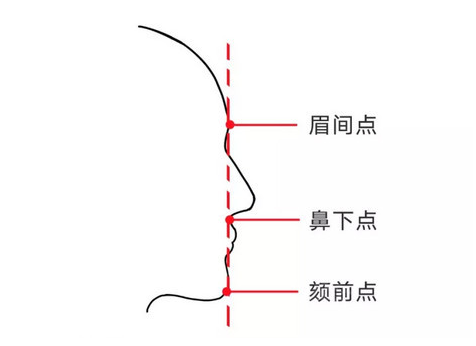 如图,直面型即鼻下点在眉间点和颏前点连线上.