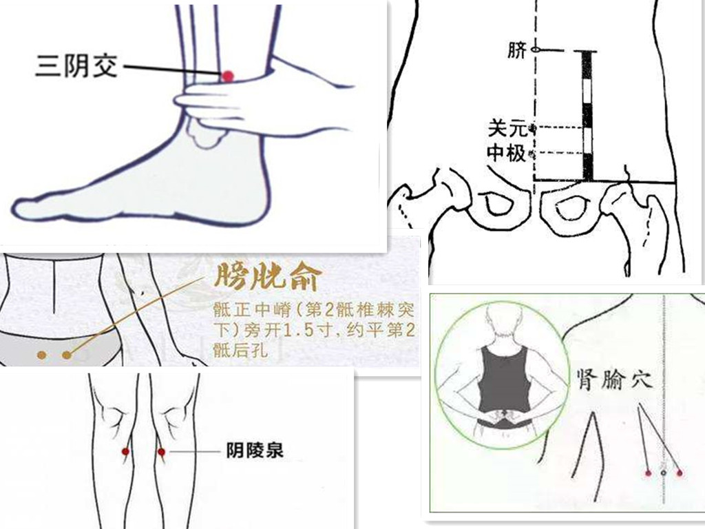 操作:关元透中极时令患者排空小便,操作时左手提起腹肌从关元穴进针