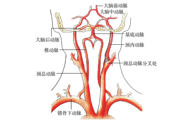 大脑中动脉分段血管图片