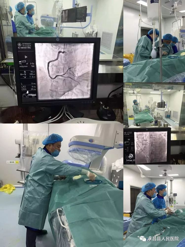 永昌县医院首次成功完成5例心脏冠状动脉造影检查术