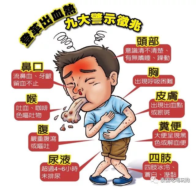 登革热也称为"出血症",症状严重的时候,患者会出现出血,血小板减少