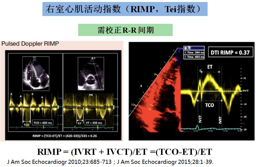 【2019cihfc】周蕾教授:超声心动图在心力衰竭评估中的应用_左室