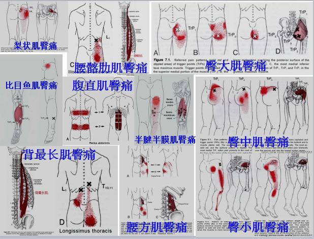 全身激痛点手册,附带3d动画视频,非常有用【疼痛医生必看】