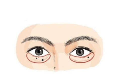 男人身上的四大克妻痣长在哪里真的会克妻性命吗