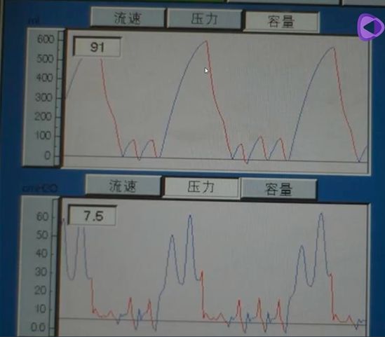 解读血氧饱和度波形图图片