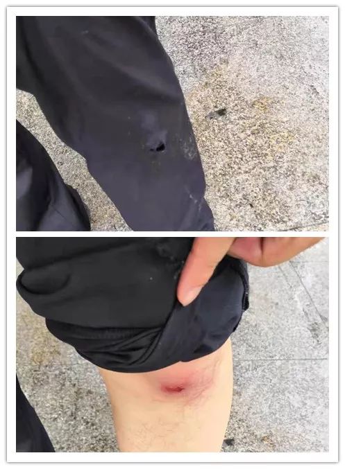 视频交警骑摩托车摔倒受伤到了医院后却又默默离开