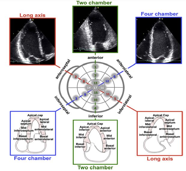 心脏17节段图片