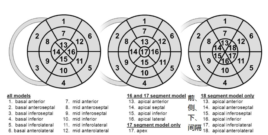 1 左室壁节段划分-16,17,18牛眼图非冠脉疾病引起的节段性室壁运动