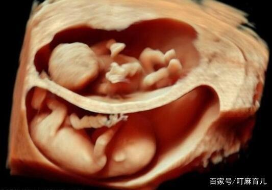 孕37周胎儿腹中图片图片