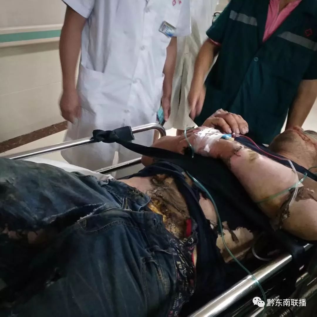 昨天,黎平一施工地工人触电 消防紧急救援