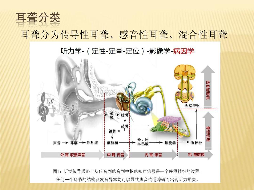 科普向:传导性耳聋