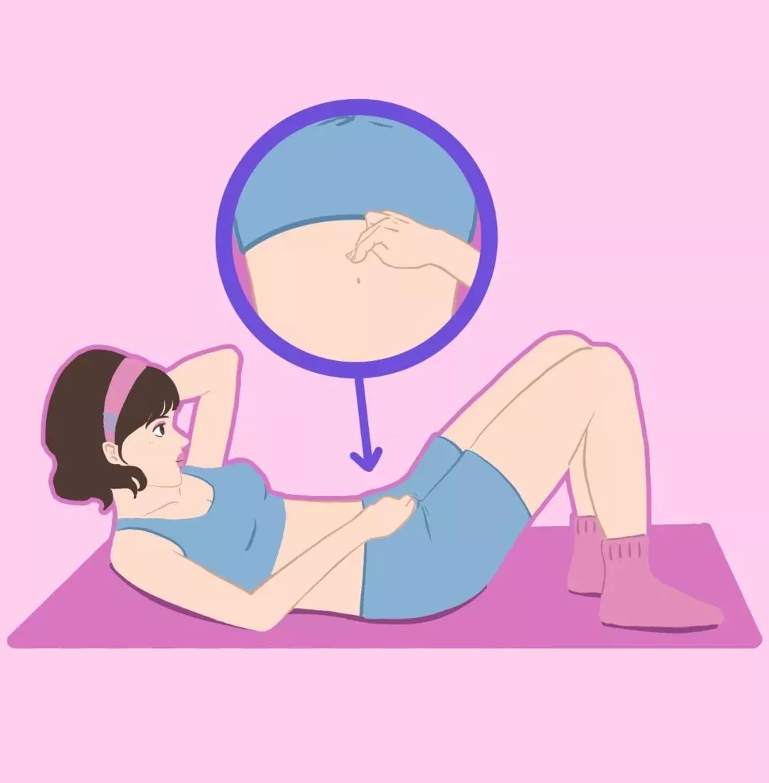 腹直肌分离