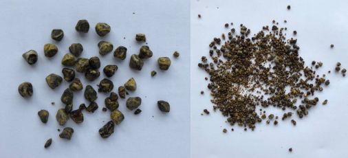 按结合主要化学成分,分为胆固醇结石,胆色素结石及混合型结石,其大小